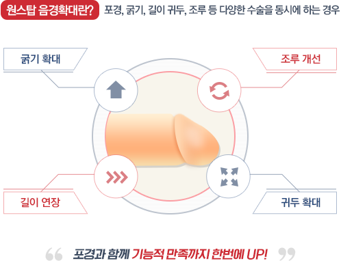 원스탑 음경확대란? 