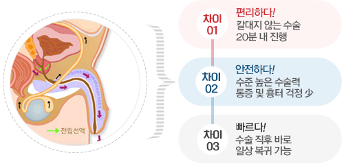 강남멘파워비뇨기과